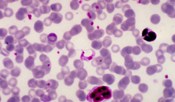 Trypanosoma Cruzi Study [Stuart Krassner, Ph.D. - University of California at Irvine]